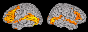 fMRI of brain activity during ASL sign comprehension